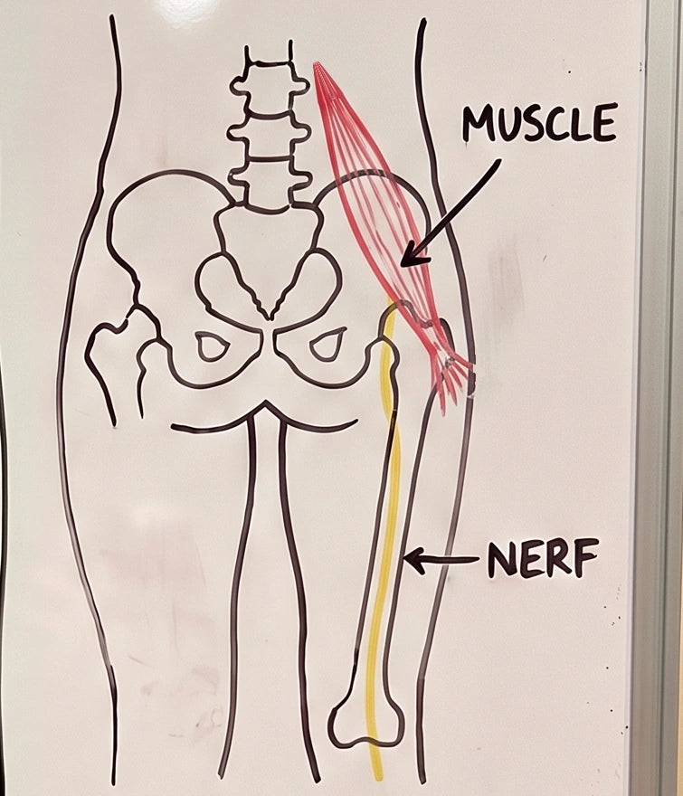 Le dessin de droite : le même muscle, long et relâché, le nerf passe libre