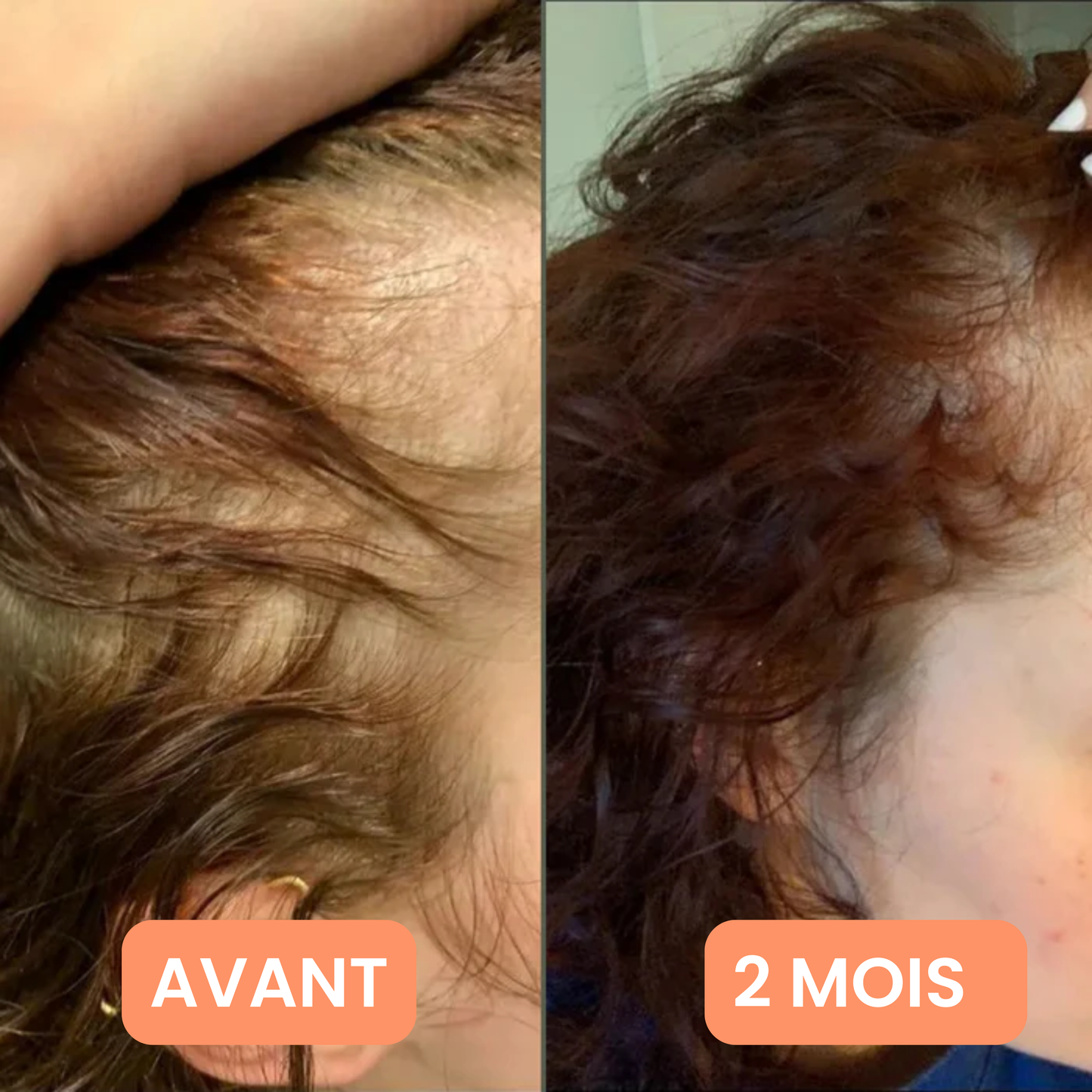 Verudia Hair Serum