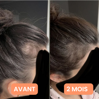 Verudia Hair Serum