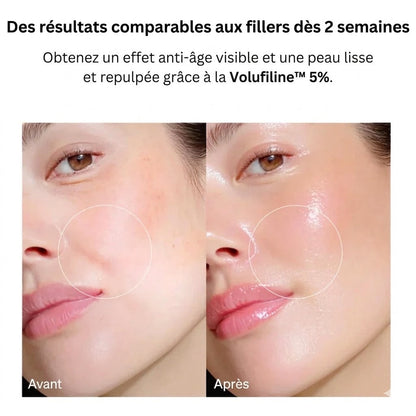 Verudia | Sérum Coréen Anti-Cernes à la Volufiline™