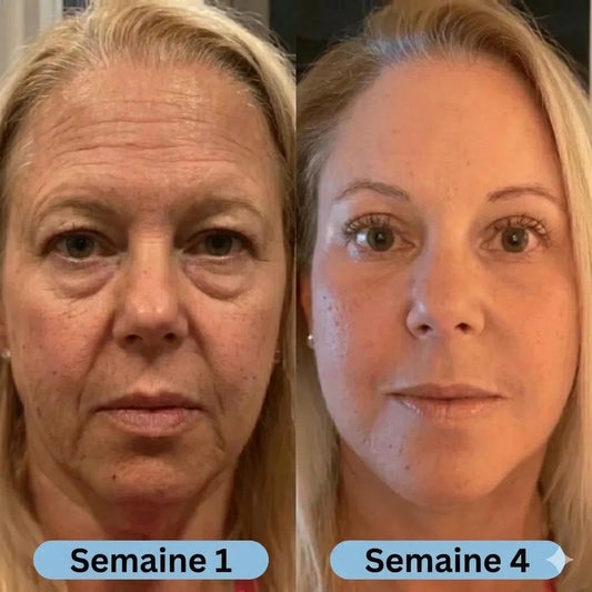 Verudia | Sérum Coréen Anti-Cernes à la Volufiline™