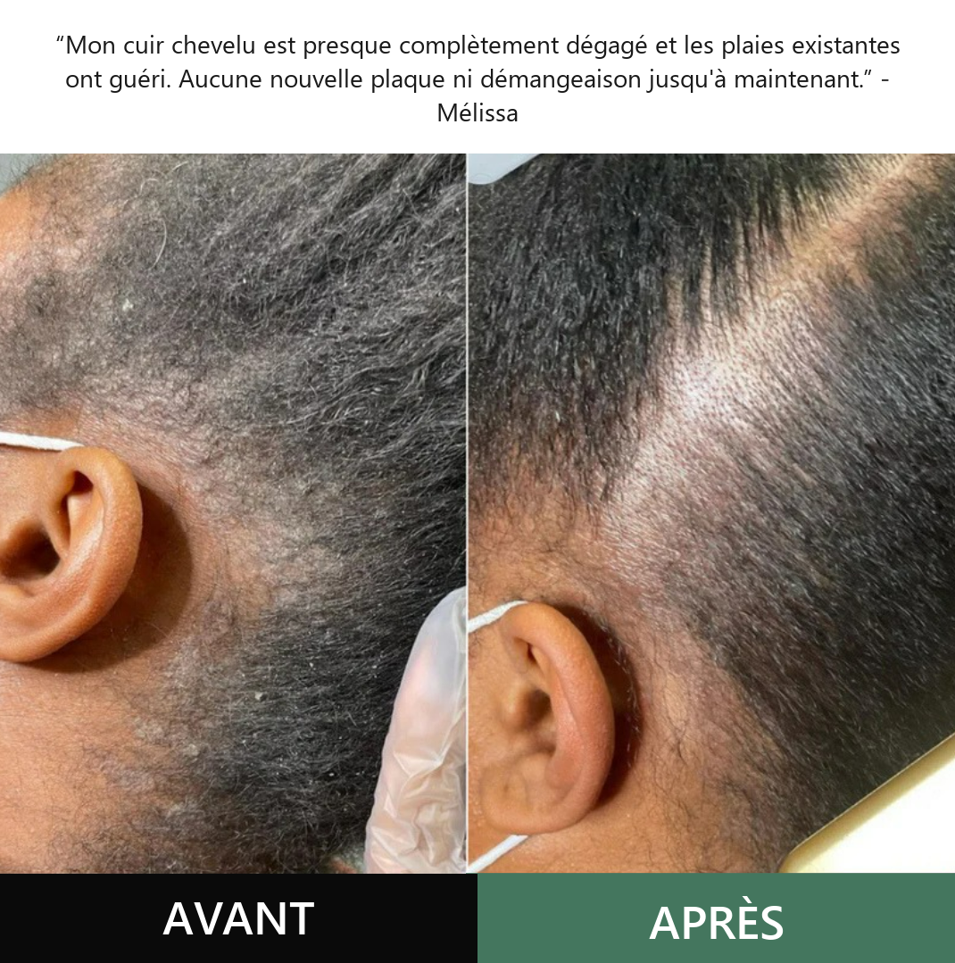 Avant / après — témoignage Mélissa
