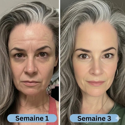Verudia | Sérum Coréen Anti-Cernes à la Volufiline™