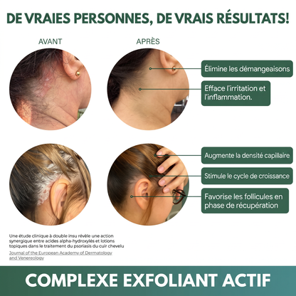 De vraies personnes, de vrais résultats — avant/après